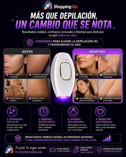 DEPILADORA LASER IPL